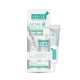 Smooth E Acne-5 Rapid Action Plus (SMOOTH-E) - 10g. Smooth E Acne-5 Rapid Action Plus (SMOOTH-E) - 10g.