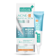 Smooth E Acne-5 Rapid Action 10g. Smooth E Acne-5 Rapid Action 10g.