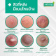 Anti Body Acne Spray Smooth E 50 ml. Anti Body Acne Spray Smooth E 50 ml.