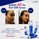 Acne Mild Moisturizer (Acnoc) - 40g. Acne Mild Moisturizer (Acnoc) - 40g.